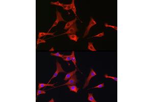 Immunofluorescence analysis of NIH-3T3 cells using PIK3CG Rabbit pAb (ABIN6130600, ABIN6145638, ABIN6145639 and ABIN6222396) at dilution of 1:100 (40x lens).