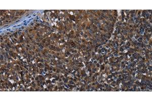 Immunohistochemistry of paraffin-embedded Human tonsil using GALT Polyclonal Antibody at dilution of 1:30 (GALT anticorps)