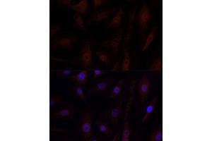 Immunofluorescence analysis of NIH/3T3 cells using YAP1 antibody.