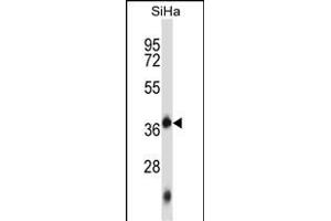 DNTTIP1 Antibody (Center) (ABIN657126 and ABIN2846270) western blot analysis in SiHa cell line lysates (35 μg/lane). (DNTTIP1 anticorps  (AA 145-174))