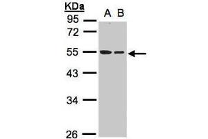 WB Image Sample(30 ug whole cell lysate) A:A431, B:Hep G2 , 10% SDS PAGE antibody diluted at 1:1000 (TUBB1 anticorps)