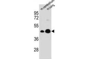 Western Blotting (WB) image for anti-Integral Membrane Protein 2B (ITM2B) antibody (ABIN2997184)