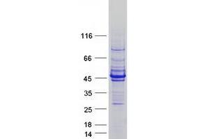 Validation with Western Blot