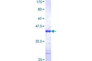 Image no. 1 for Scaffold Attachment Factor B (SAFB) (AA 111-200) protein (GST tag) (ABIN1319112)