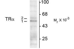 Western Blotting (WB) image for anti-Thyroid Hormone Receptor, alpha (THRA) (N-Term) antibody (ABIN371843) (THRA anticorps  (N-Term))