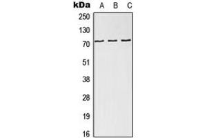 Western blot analysis of NDC80 expression in HEK293T (A), SP2/0 (B), H9C2 (C) whole cell lysates.