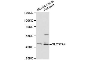 Western blot analysis of extracts of various cell lines, using SLC37A4 antibody. (SLC37A4 anticorps)