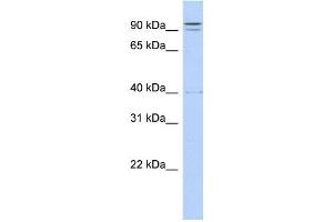 WB Suggested Anti-TTC14 Antibody Titration:  0. (TTC14 anticorps  (N-Term))