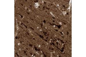Immunohistochemical staining of human cerebral cortex with HS6ST2 polyclonal antibody  shows strong cytoplasmic positivity in neuronal cells at 1:50-1:200 dilution.