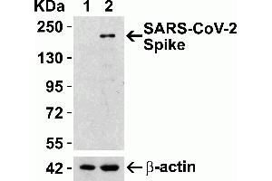 Overexpression Validation in Spike Transfected 293 Cells Loading: 10 μg per lane of 293 cell lysate. (SARS-CoV-2 Spike anticorps  (RBD))
