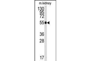Western blot analysis of anti-ALDH9A1 Antibody (C-term) (ABIN392321 and ABIN2841971) in mouse kidney tissue lysates (35 μg/lane). (ALDH9A1 anticorps  (C-Term))