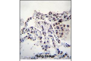 MEIG1 Antibody (Center) (ABIN656380 and ABIN2845675) immunohistochemistry analysis in formalin fixed and paraffin embedded human lung tissue followed by peroxidase conjugation of the secondary antibody and DAB staining. (MEIG1 anticorps  (AA 36-65))