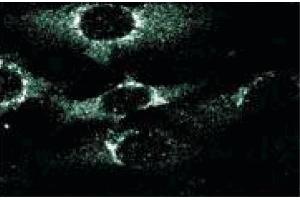 Immunofluorescence staining of human endothelial cells.