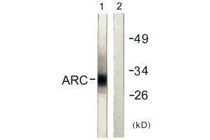 Western blot analysis of extracts from HeLa cells, using ARC antibody. (ARC anticorps)