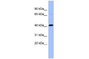 WB Suggested Anti-CFP Antibody Titration: 0. (CFP anticorps  (N-Term))
