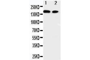 Anti-ErbB 4 antibody, Western blotting Lane 1: A549 Cell Lysate Lane 2: HELA Cell Lysate