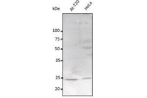 Anti-Rab11a Ab at 1/2,500 dilution, Iysates at 100 µg per Ilane, rabbit poIycIonaI to goat IgG(HRP) at 1/10,000 dilution, (RAB11A anticorps  (C-Term))