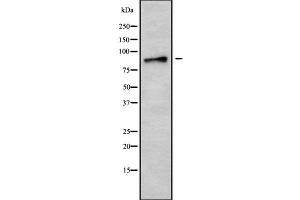 Western blot analysis of AMPD3 using MCF7 whole cell lysates (AMPD3 anticorps  (Internal Region))