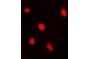 Immunofluorescent analysis of BTEB1 staining in A549 cells. (KLF9 anticorps)