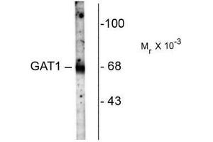 Image no. 1 for anti-GABA Transporter 1 (GAT1) (C-Term) antibody (ABIN372646) (SLC6A1 anticorps  (C-Term))