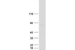 Validation with Western Blot