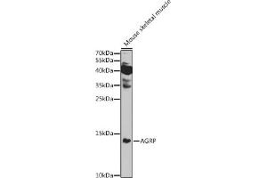 Western blot analysis of extracts of Mouse skeletal muscle, using AGRP antibody (ABIN7265515) at 1:1000 dilution. (AGRP anticorps  (AA 21-132))