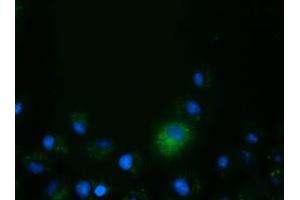 Anti-CD80 mouse monoclonal antibody (ABIN2452902) immunofluorescent staining of COS7 cells transiently transfected by pCMV6-ENTRY CD80 (RC206540).