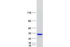Validation with Western Blot