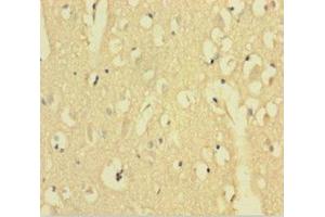 Immunohistochemistry of paraffin-embedded human brain tissue using ABIN7143589 at dilution of 1:100 (Aftiphilin anticorps  (AA 752-889))