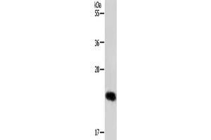 Gel: 12 % SDS-PAGE, Lysate: 40 μg, Lane: MCF7 cells, Primary antibody: ABIN7192097(RAB22A Antibody) at dilution 1/650, Secondary antibody: Goat anti rabbit IgG at 1/8000 dilution, Exposure time: 30 seconds (RAB22A anticorps)