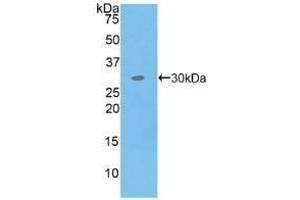 Detection of Recombinant MAP4K5, Human using Polyclonal Antibody to Mitogen Activated Protein Kinase Kinase Kinase Kinase 5 (MAP4K5)
