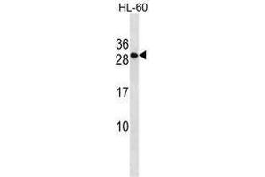 TMED6 Antibody (Center) western blot analysis in HL-60 cell line lysates (35 µg/lane). (TMED6 anticorps  (Middle Region))