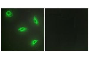 Immunofluorescence analysis of HeLa cells, using TNF14 antibody. (TNFSF14 anticorps  (Internal Region))