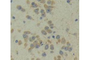IHC-P analysis of Kidney tissue, with DAB staining. (CITED1 anticorps  (C-Term))