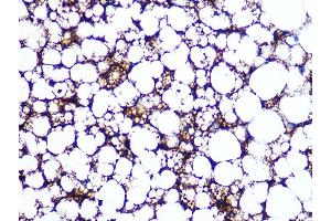 Immunohistochemistry of paraffin-embedded rat brown adipose using Perilipin A Rabbit mAb (ABIN7269218) at dilution of 1:100 (40x lens). (PLIN1 anticorps)