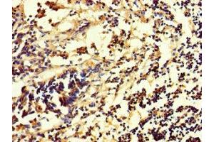 Immunohistochemistry of paraffin-embedded human appendix tissue using ABIN7154641 at dilution of 1:100 (RHEBL1 anticorps  (AA 1-180))