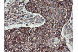 Image no. 9 for anti-Tumor Protein D52-Like 3 (TPD52L3) antibody (ABIN1501475)