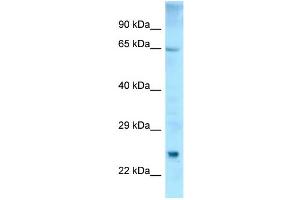 WB Suggested Anti-ETFDH Antibody Titration: 1. (ETFDH anticorps  (C-Term))