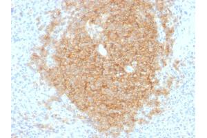 Formalin-fixed, paraffin-embedded human Spleen stained with CD40 Mouse Monoclonal Antibody (C40/1605).