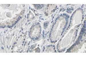 ABIN6274786 at 1/100 staining Human prostate tissue by IHC-P. (PGLS anticorps  (C-Term))