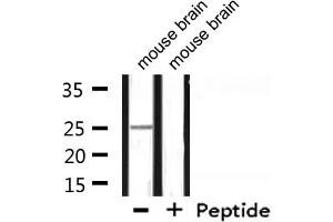 Western blot analysis of extracts from mouse brain, using RPL10 Antibody. (RPL10 anticorps  (N-Term))