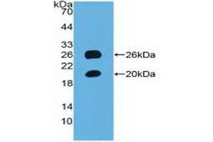 Detection of Recombinant SPON1, Mouse using Polyclonal Antibody to Spondin 1 (SPON1) (SPON1 anticorps  (AA 608-802))
