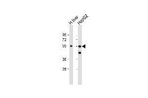 All lanes : Anti-CPN1 Antibody (N-term) at 1:1000 dilution Lane 1: human liver lysate Lane 2: HepG2 whole cell lysate Lysates/proteins at 20 μg per lane.