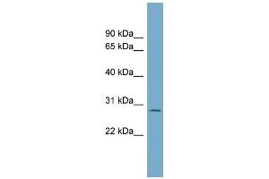 WB Suggested Anti-C1orf96 Antibody Titration: 0. (CCSAP anticorps  (N-Term))