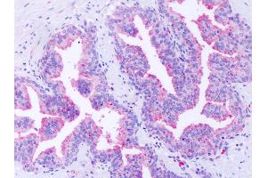 Anti-GPR63 antibody IHC of human prostate.
