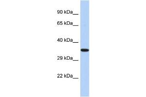 Western Blotting (WB) image for anti-Epoxide Hydrolase 4 (EPHX4) (C-Term) antibody (ABIN2786305) (EPHX4 anticorps  (C-Term))