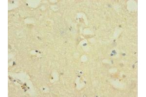 Immunohistochemistry of paraffin-embedded human brain tissue using ABIN7161009 at dilution of 1:100 (NOX3 anticorps  (AA 223-395))