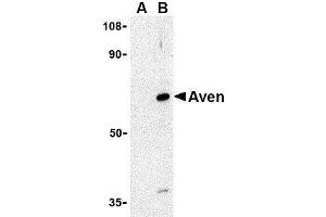 Western blot analysis of Aven in Raji cell lysate with AP30099PU-N Aven antibody at 1 μg/ml in (A) the presence and (B) the absence of blocking peptide. (AVEN anticorps  (N-Term))