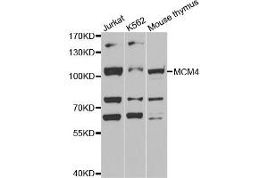 Western blot analysis of extracts of various cell lines, using MCM4 antibody (ABIN5971548) at 1:400 dilution. (MCM4 anticorps)