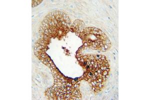 Immunohistochemistry (IHC) image for anti-Lymphocyte-Activation Gene 3 (LAG3) antibody (ABIN3002914) (LAG3 anticorps)